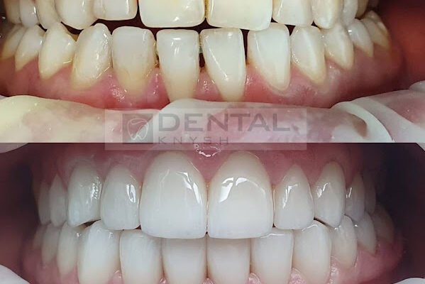 Стоматологічна клініка DentalKnysh — Львів
