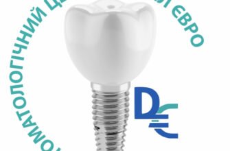 Стоматологічна клініка Dental Euro у Львові: якість та турбота