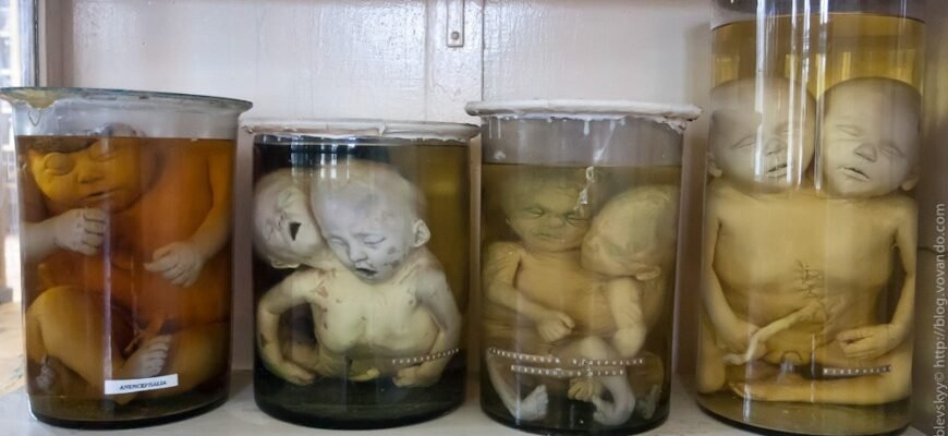 Музей хвороб людини: інтерактивні зображення, що вражають уяву