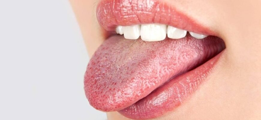 Пече язик: ефективні народні методи лікування та поради