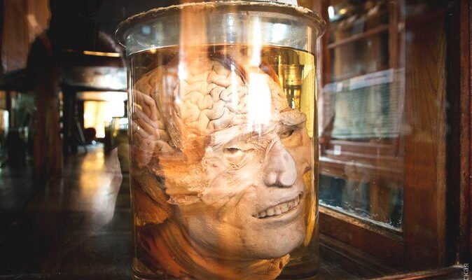 Анатомічний музей Одеси: унікальна подорож крізь людське тіло