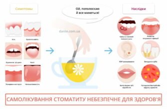 Хто лікує стоматит: знайдіть свого спеціаліста для лікування