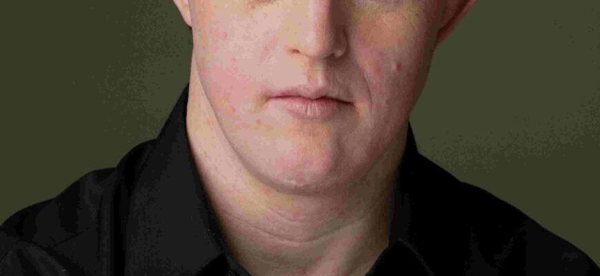 Хто такий даун: розуміння терміна у сучасному суспільстві