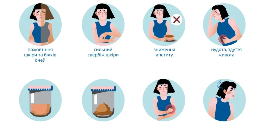 Як прибрати жовч з шлунку: ефективні методи та поради лікарів