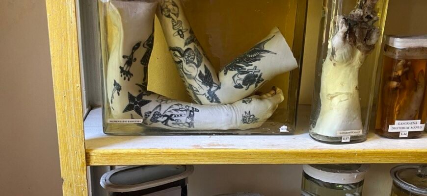 Музей хвороб людини: подорож у світ медичних загадок та історій