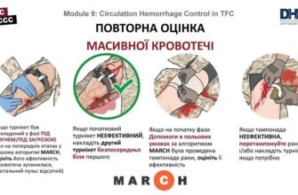 Ефективні методи зупинки кровотечі: повний гайд для кожного випадку