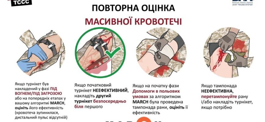 Які методи зупинки критичної кровотечі: ефективні рішення та поради