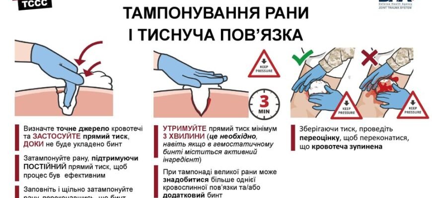 Ефективні методи тимчасової зупинки кровотечі: огляд і поради