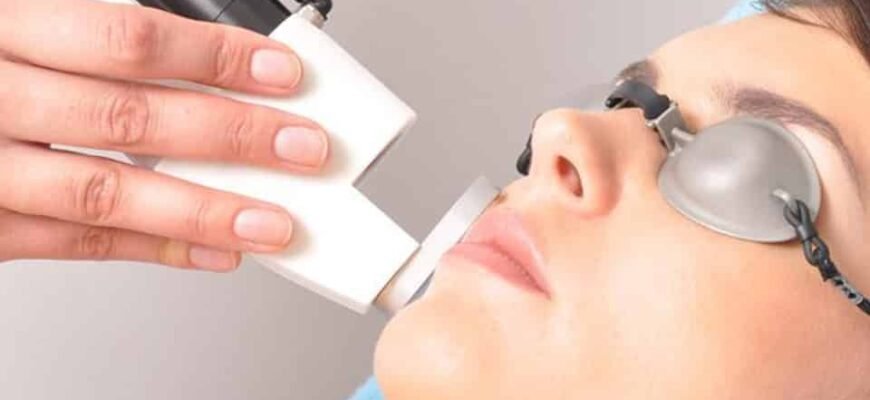 Народні методи видалення волосся на обличчі: найефективніші рішення