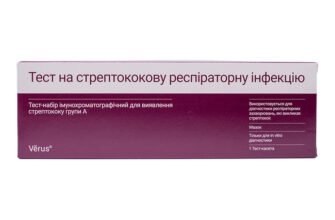 Як розпізнати стрептокок: важливість тесту на стрептокок