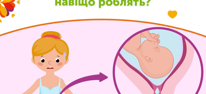 Як відрізнити підтікання вод від виділень: корисні поради для жінок