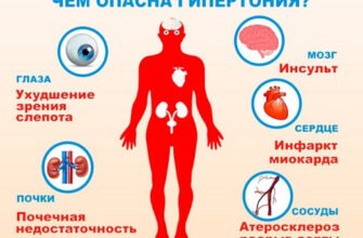 Що робити при високому тиску в домашніх умовах: поради та дії