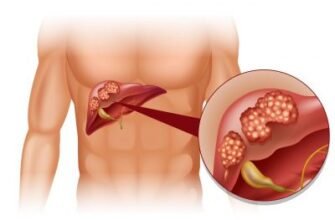 Дифузні зміни в печінці: причини, симптоми та лікування