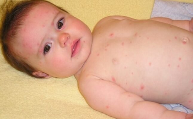 Причини та наслідки: чому нейтрофіли підвищені у дитини?