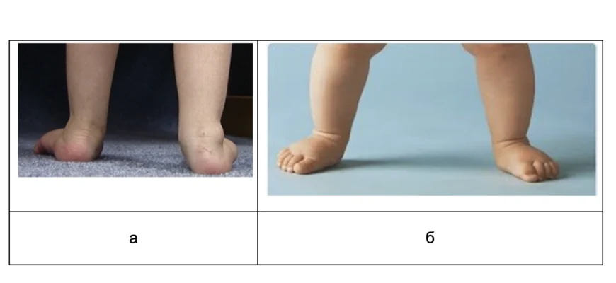 У дитини болять ноги: обговорення і поради батьків на форумі У дитини болять ноги: обговорення і поради батьків на форумі