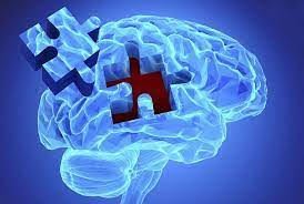 Що таке когнітивні порушення: визначення, симптоми, причини?