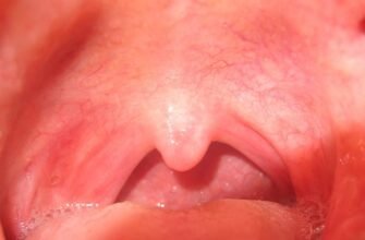 Як виглядає здорове горло у дитини: ознаки та поради для батьків