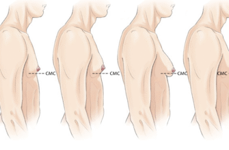 Гулька на грудях у дитини 9 років: причини та що робити батькам
