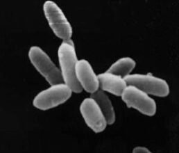 Що таке археї: визначення, характеристики та значення у природі