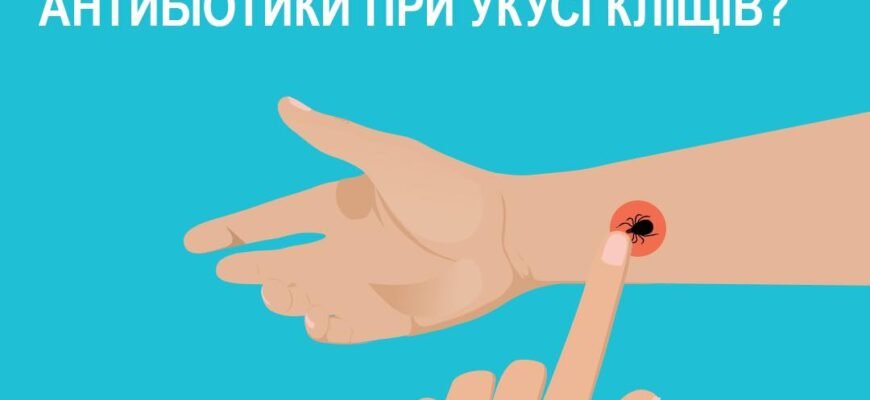 Антибіотики при укусі кліща: як вибрати і коли приймати?