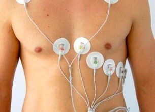 Що таке холтер: як працює та для чого використовують прилад?