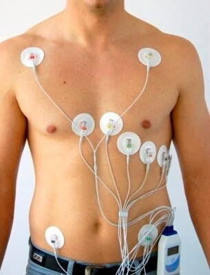 Що таке холтер: як працює та для чого використовують прилад? Що таке холтер: як працює та для чого використовують прилад?