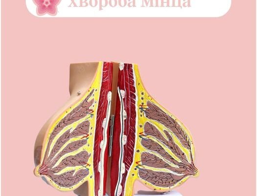 Хвороба Мінца: це симптоми, причини та методи лікування