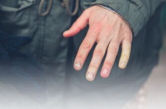 Чи виліковна хвороба Рейно: сучасні методи лікування та діагностика