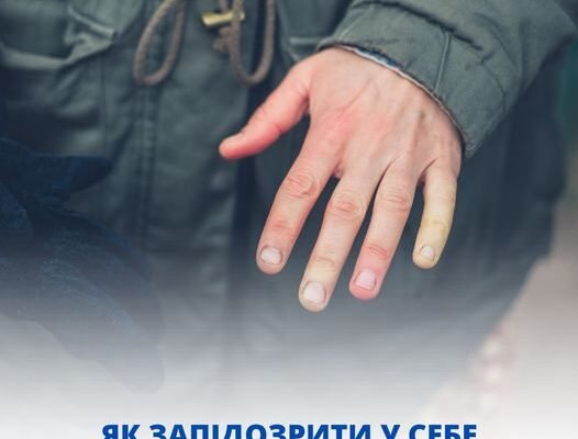 Чи виліковна хвороба Рейно: сучасні методи лікування та діагностика Чи виліковна хвороба Рейно: сучасні методи лікування та діагностика