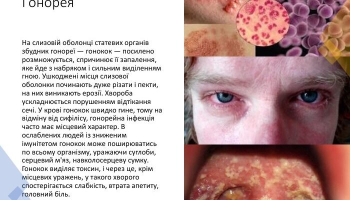 Причини та лікування статевих інфекцій у чоловіків: повний гайд Причини та лікування статевих інфекцій у чоловіків: повний гайд