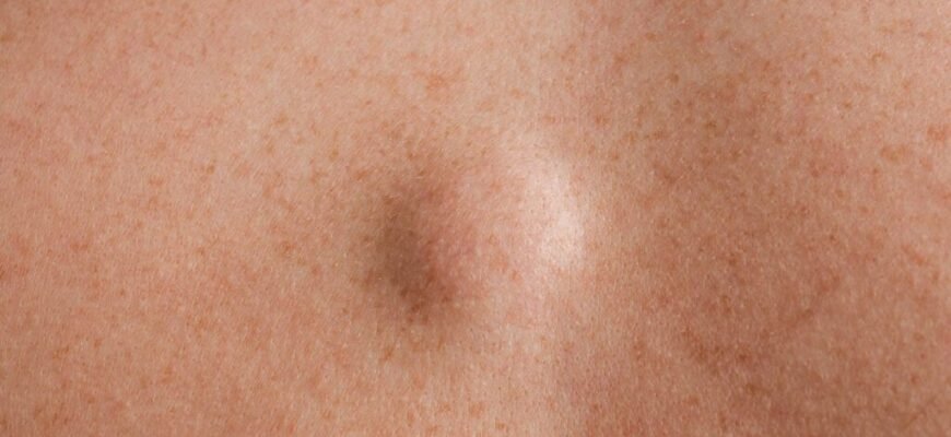 Обговорення: гулька на голові у дитини – поради та досвід батьків