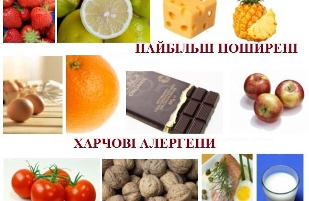 Що не можна їсти при алергії: ключові продукти для уникнення