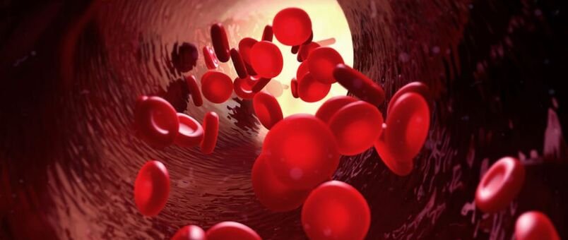 Мієломна хвороба: основні ускладнення та їх лікування Мієломна хвороба: основні ускладнення та їх лікування