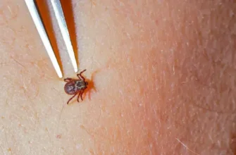 Хвороба людини, спричинена одним із видів кліщів: причини та симптоми