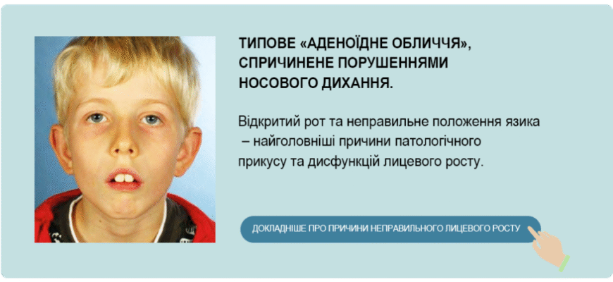 Аденоїдне обличчя у дитини: причини, симптоми та лікування
