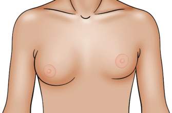 Гулька на грудях у дитини 10 років: причини і що робити