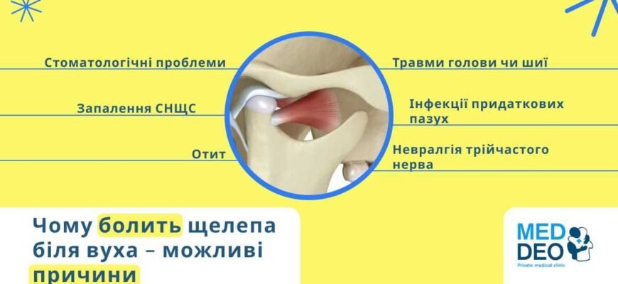 Причини болю в щелепі при відкриванні рота: що варто знати?