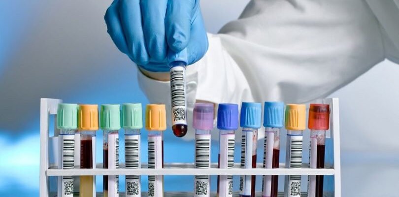 Знижені нейтрофіли у дитини: причини, симптоми та лікування