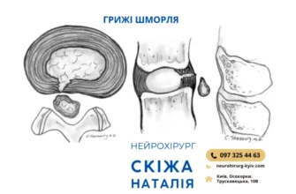 При яких захворюваннях хребта дають інвалідність: повний огляд