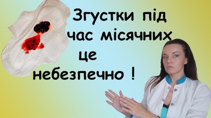 Згусток крові при місячних: причини, симптоми та лікування