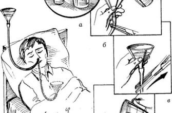 Які продукти вводити перорально через шлунковий зонд: практичний гід