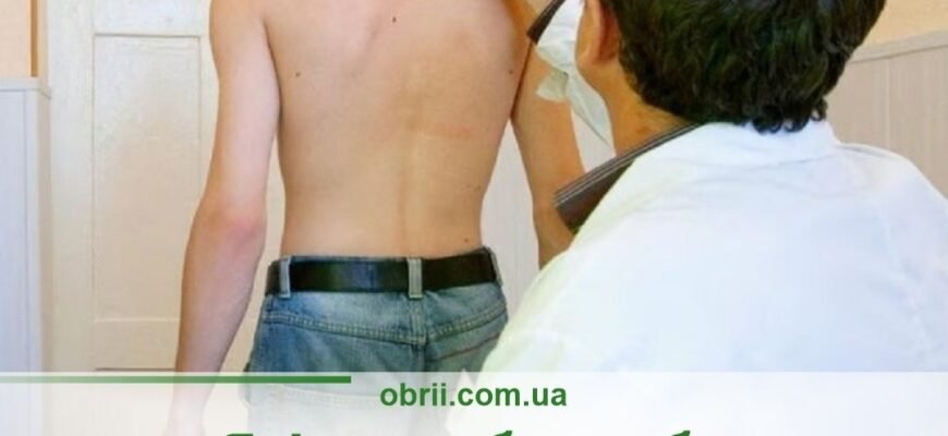 Які хвороби хребта звільняють від мобілізації в Україні?