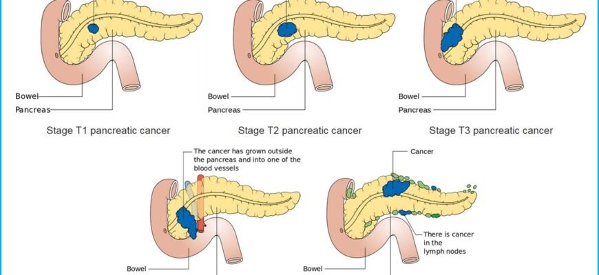 Реактивні зміни підшлункової залози: причини та ознаки