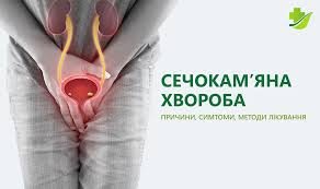 Сечокам’яна хвороба: дієта для профілактики та лікування симптомів Сечокам’яна хвороба: дієта для профілактики та лікування симптомів