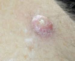 Хвороба шкіри: причини, симптоми та методи лікування ефективні