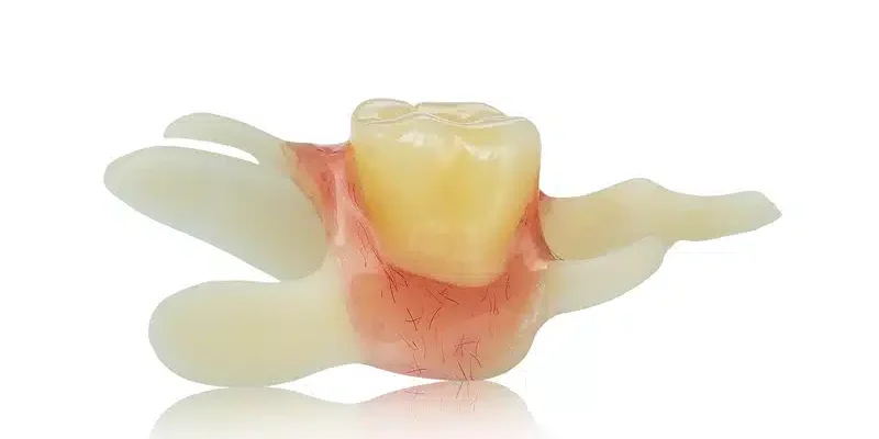 Метатуберкульозні зміни: причини, симптоми та способи лікування