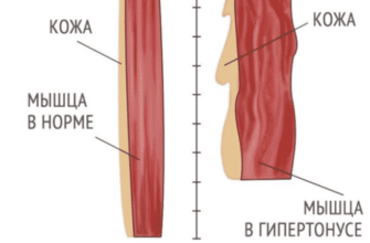 Гіпертонус м’язів у дитини 2 роки: діагностика та поради батькам