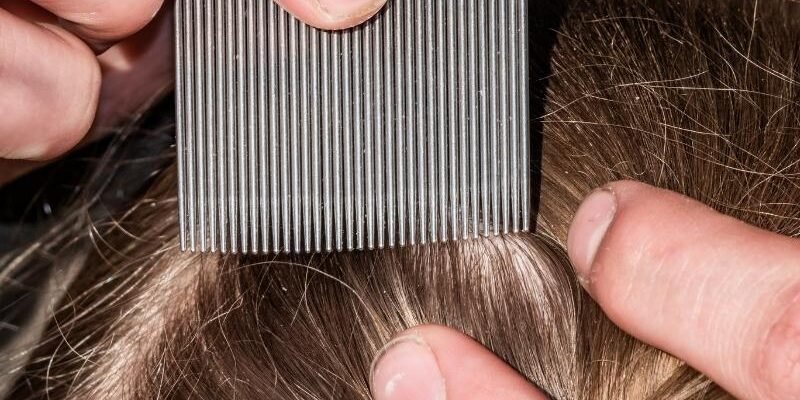 Як вивести воші у дитини: ефективні та безпечні методи боротьби