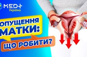 Вправи Кегеля при опущенні матки: відео та поради для жінок