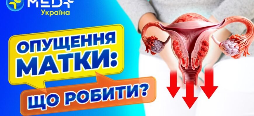 Вправи Кегеля при опущенні матки: відео та поради для жінок